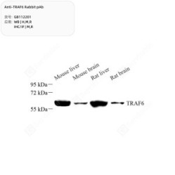 Anti-TRAF6 Rabbit pAb - 50 µL