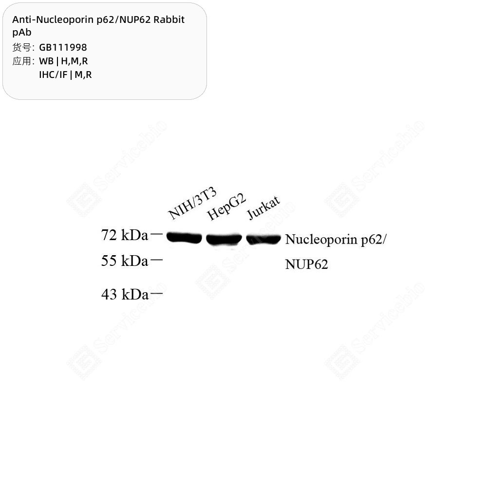 Anti-Nucleoporin p62/NUP62 Rabbit pAb - 50 µL