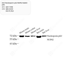 Anti-Nucleoporin p62/NUP62 Rabbit pAb - 50 µL