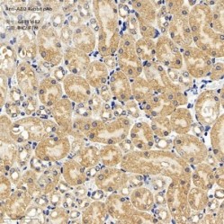 Anti-AZI2 Rabbit pAb - 50 µL