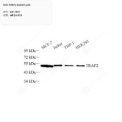 Anti-TRAF2 Rabbit pAb - 50 µL