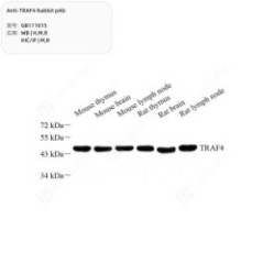 Anti-TRAF4 Rabbit pAb - 50 µL