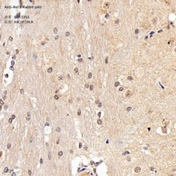 Anti-Rel B Rabbit pAb - 50 µL