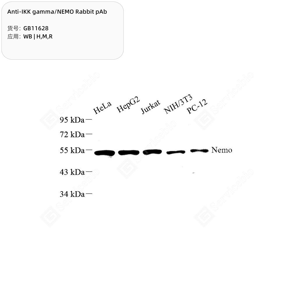 Anti-IKK gamma/NEMO Rabbit pAb - 50 µL