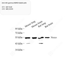 Anti-IKK gamma/NEMO Rabbit pAb - 50 µL