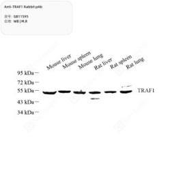 Anti-TRAF1 Rabbit pAb - 50 µL