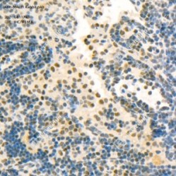 Anti-MALT1 Rabbit pAb - 50 µL