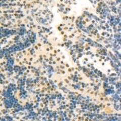 Anti-MALT1 Rabbit pAb - 50 µL