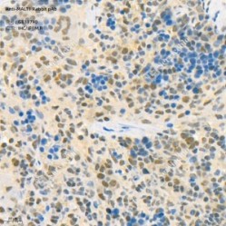 Anti-MALT1 Rabbit pAb - 50 µL