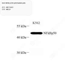 Anti-NFkB p105/p50 Rabbit pAb - 100 µL