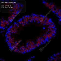 Anti-TRAFD1 Rabbit pAb - 100 µL