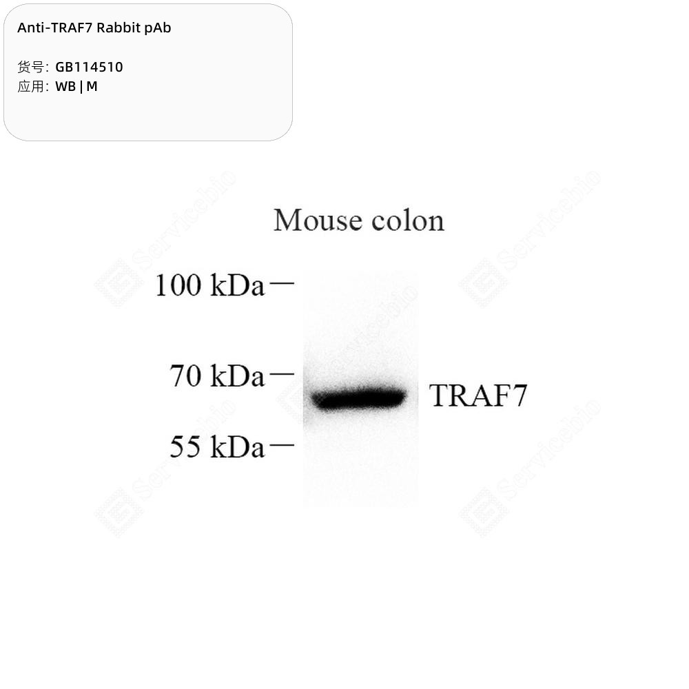 Anti-TRAF7 Rabbit pAb - 100 µL
