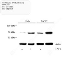 Anti-Phospho-NF-kB p65...