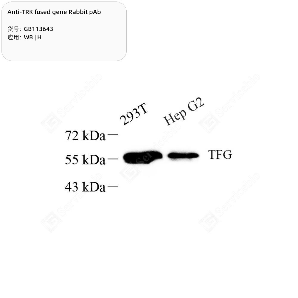 Anti-TRK fused gene Rabbit pAb - 100 µL