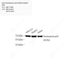 Anti-Nucleoporin p62/NUP62...