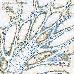 Anti-Nucleoporin p62/NUP62 Rabbit pAb - 100 µL