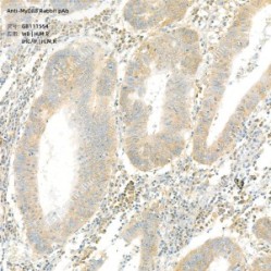 Anti-MyD88 Rabbit pAb - 100 µL