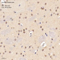 Anti-Rel B Rabbit pAb - 100 µL
