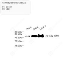 Anti-NFkB p100/NFKB2 Rabbit...
