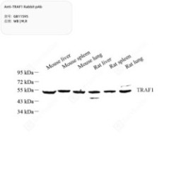 Anti-TRAF1 Rabbit pAb - 100 µL