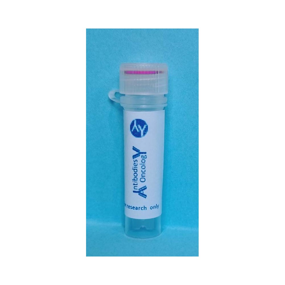 Anti-Fibronectin Rabbit pAb, Primary Antibody