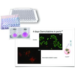 Universal 3D cell culture in perlo™ Plate