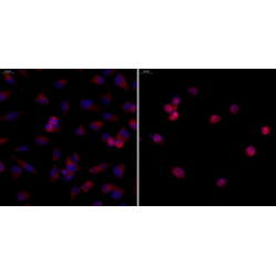 Anti-NF-κB p65 Rabbit pAb, Primary Antibody