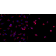 Anti-NF-κB p65 Rabbit pAb,...