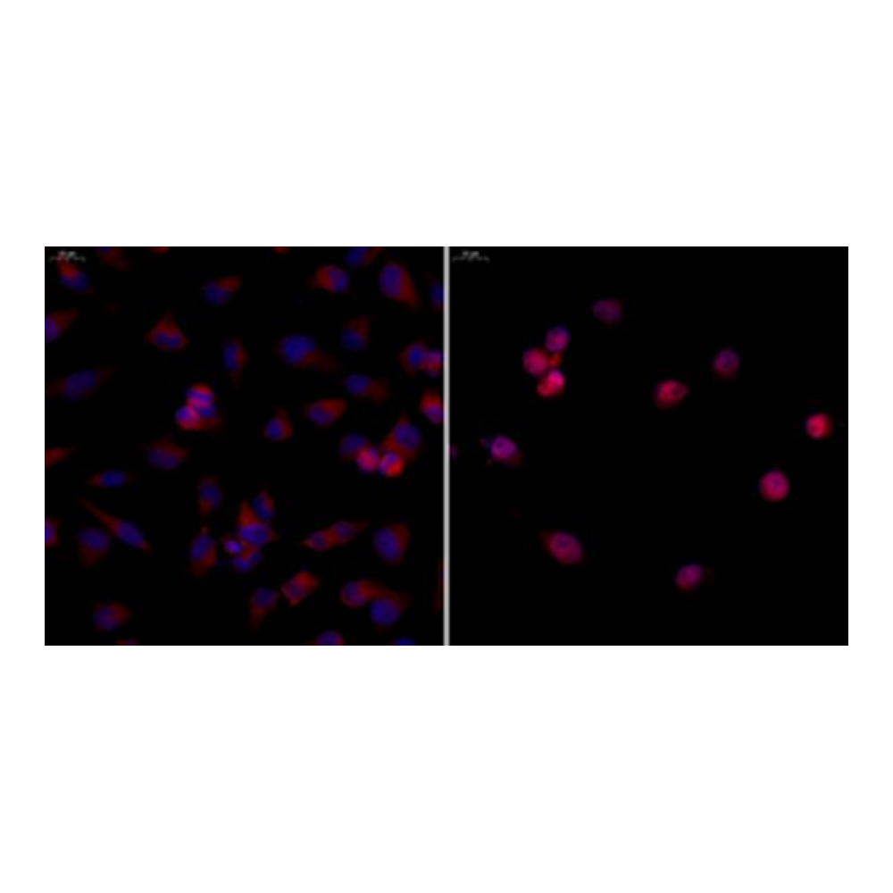 Anti-NF-κB p65 Rabbit pAb, Primary Antibody