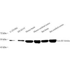 Recombinant Anti-beta III...
