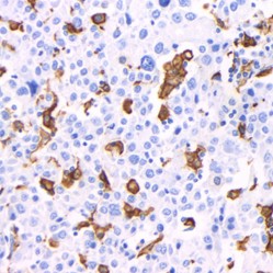 Recombinant Anti-Iba1 antibody (Mouse mAb), Primary Antibody