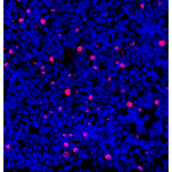 Anti-FOXP3 Rabbit pAb, Primary Antibody