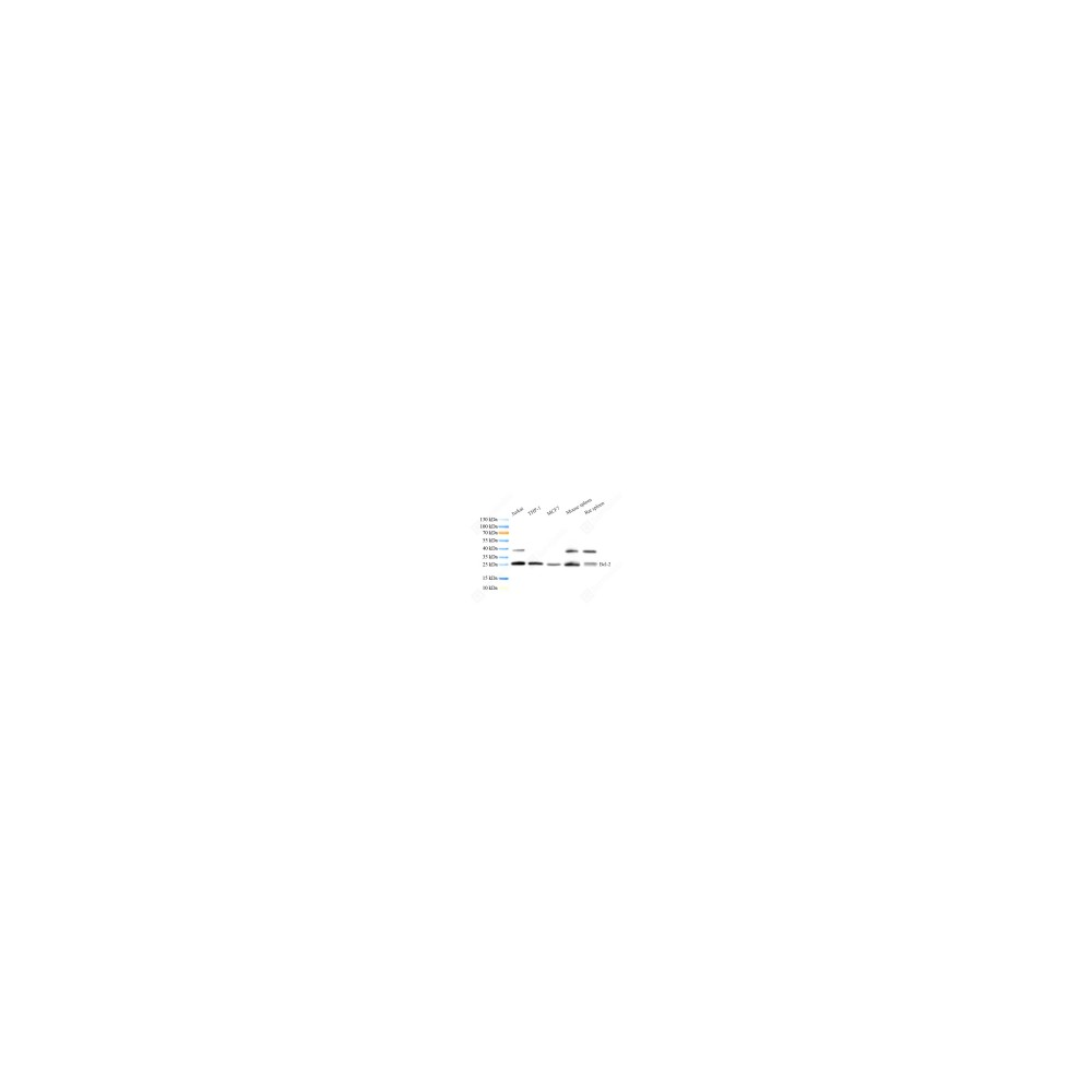 Recombinant Anti-Bcl-2 antibody (Mouse mAb)