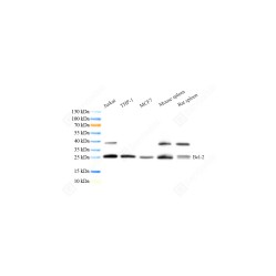 Recombinant Anti-Bcl-2 antibody (Mouse mAb)