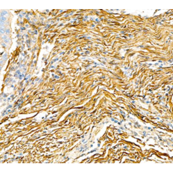 Anti-alpha smooth muscle Actin Rabbit pAb, Primary Antibody