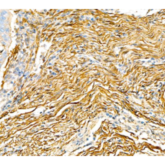 Anti-alpha smooth muscle...