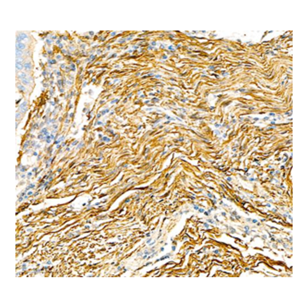 Anti-alpha smooth muscle Actin Rabbit pAb, Primary Antibody