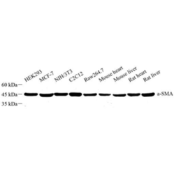 Anti-alpha smooth muscle Actin Rabbit pAb, Primary Antibody