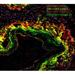 Anti-alpha smooth muscle Actin Rabbit pAb, Primary Antibody