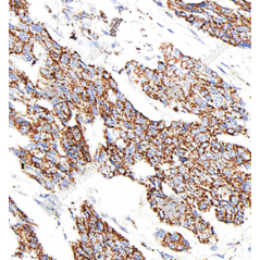 Recombinant Anti-Bax...