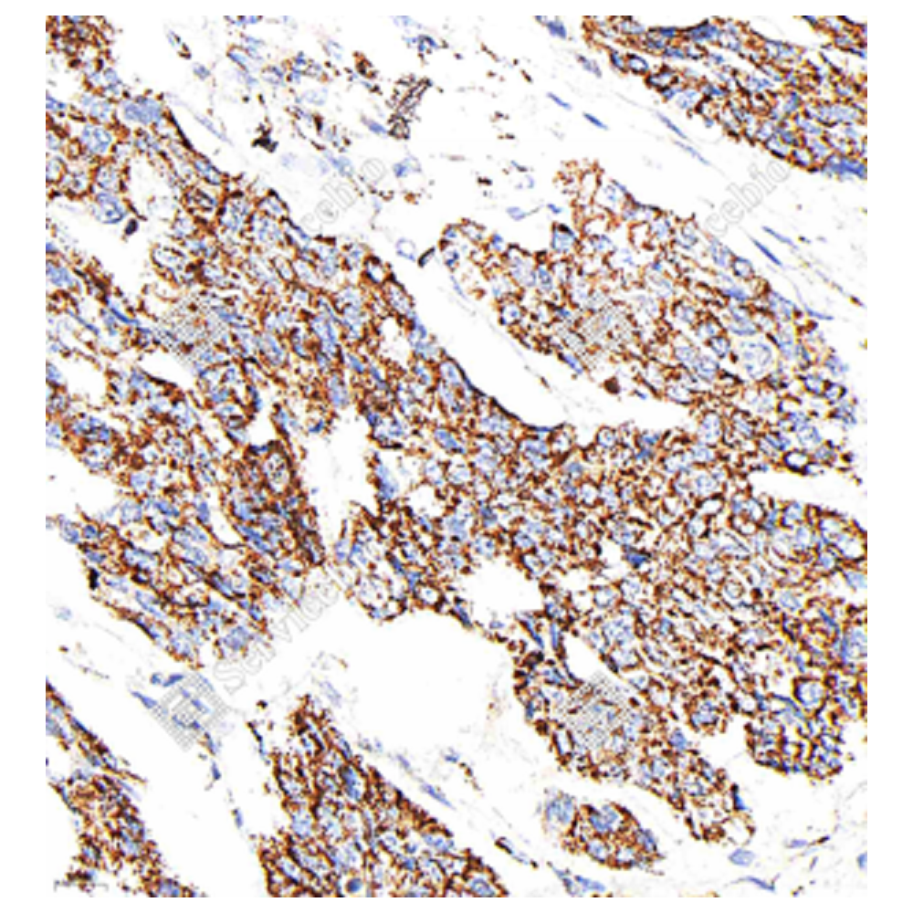 Recombinant Anti-Bax antibody (Rabbit mAb), Primary Antibody
