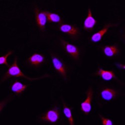 Anti-ANKLE1 Rabbit pAb, Primary Antibody