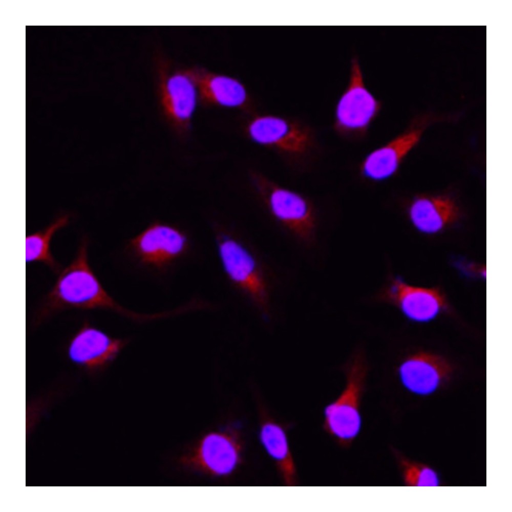 Anti-ANKLE1 Rabbit pAb, Primary Antibody