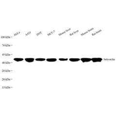 Recombinant Anti-beta Actin...