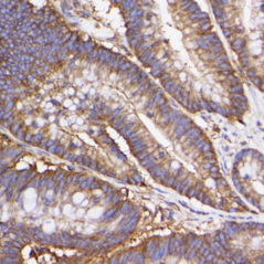 Recombinant Anti-beta Actin...