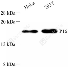 Anti-CDKN2A/p16INK4a Mouse...