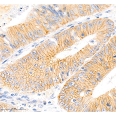 Anti-Occludin Rabbit pAb,...