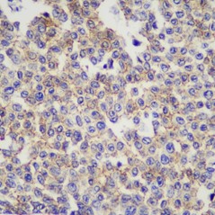 Anti-Claudin 1 Mouse mAb,...
