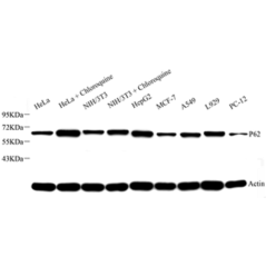 Anti-SQSTM1/p62 Rabbit pAb,...