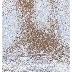 Recombinant Anti-CD3...